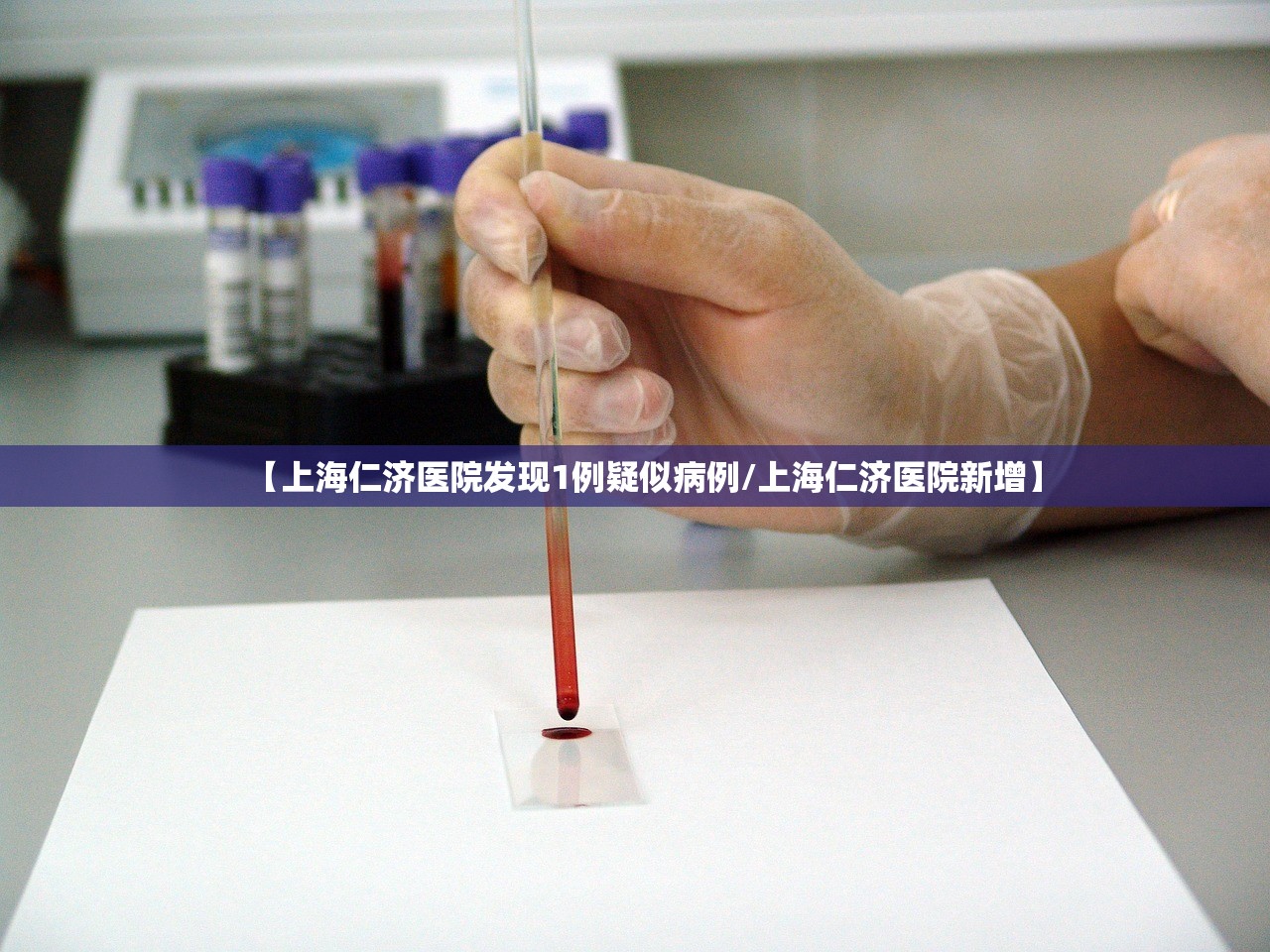 【上海仁济医院发现1例疑似病例/上海仁济医院新增】