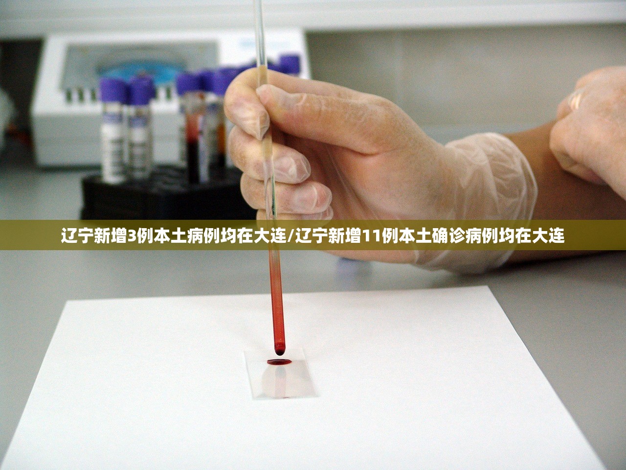 辽宁新增3例本土病例均在大连/辽宁新增11例本土确诊病例均在大连