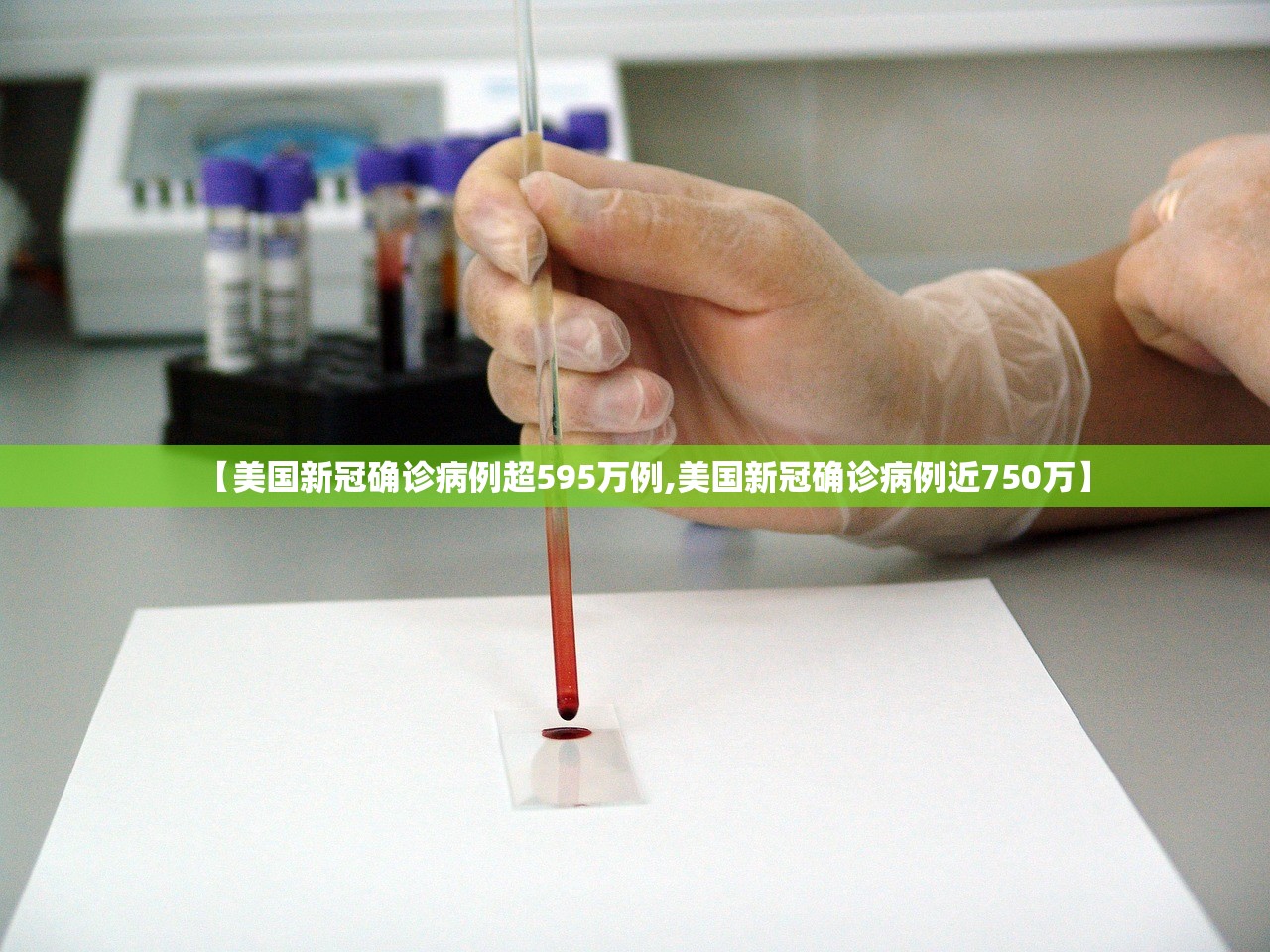 【美国新冠确诊病例超595万例,美国新冠确诊病例近750万】