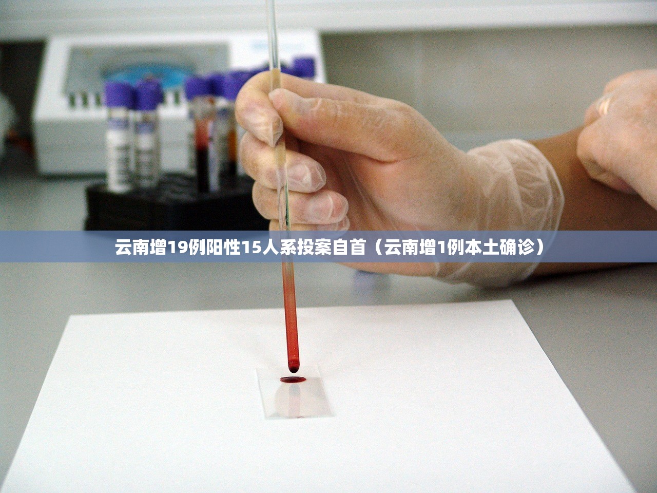 云南增19例阳性15人系投案自首（云南增1例本土确诊）