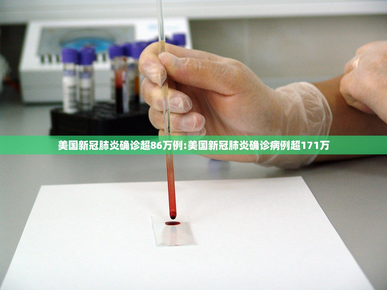 美国新冠肺炎确诊超86万例:美国新冠肺炎确诊病例超171万